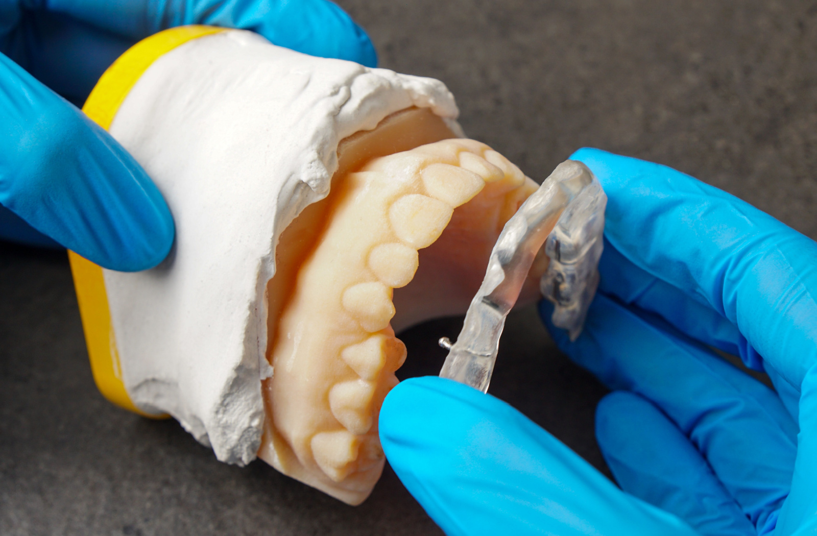 Dentist adjusting a mouth guard on a dental mould.