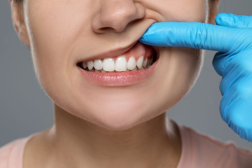 a woman is getting her gums examined by an oral care professional to see if her Bruxism is causing bleeding gums.