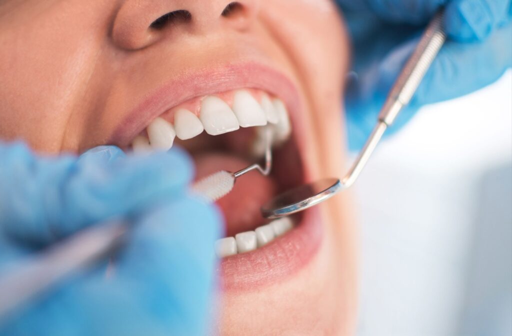 Close-up of a patient receiving a dental checkup, with dental tools and gloved hands visible inside the mouth.