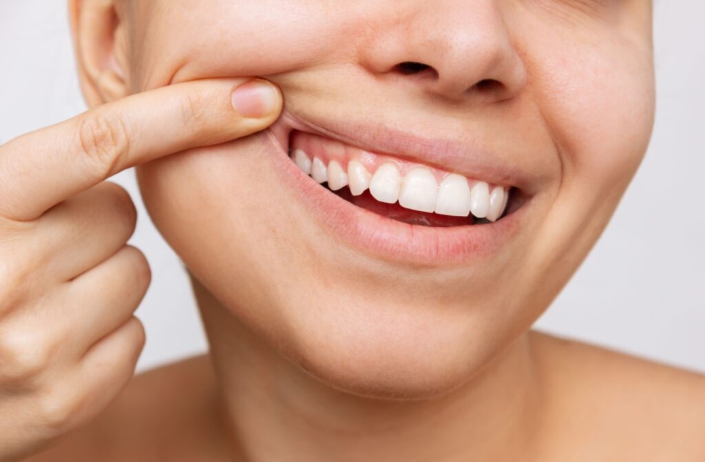 Close-up of a person smiling and gently pulling back their cheek to reveal healthy teeth and gums.