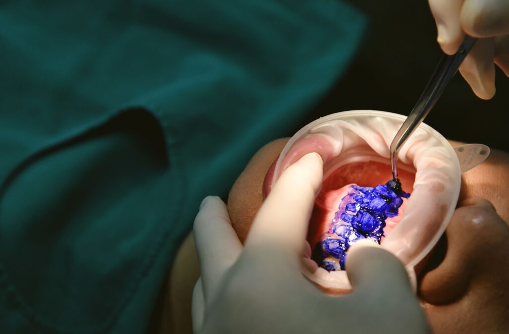 A dental hygienist carefully applies the staining solution to a patient's teeth to uncover the biofilm.